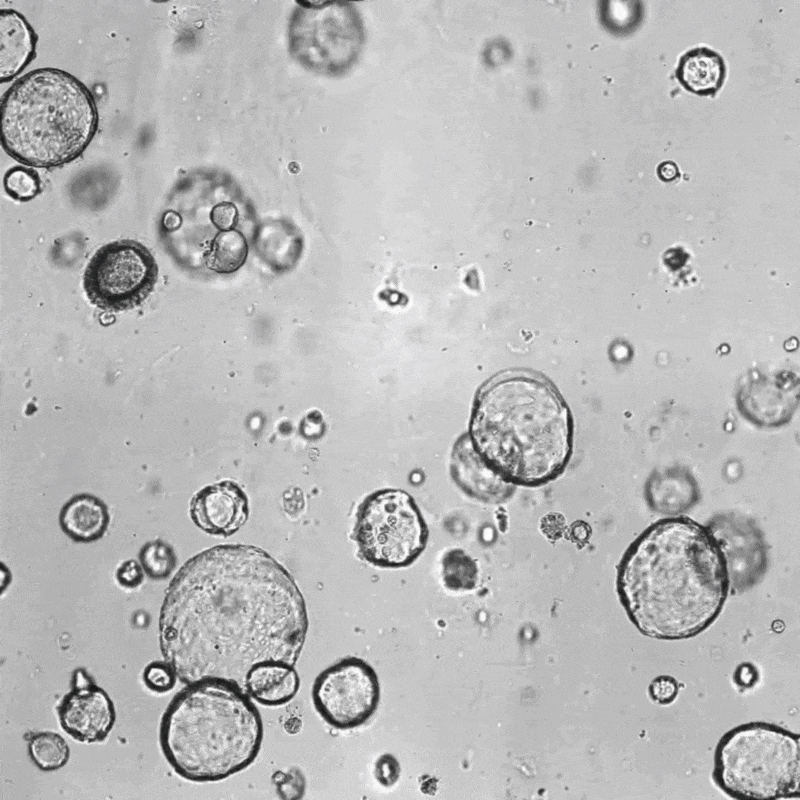Axion BioSystems ad