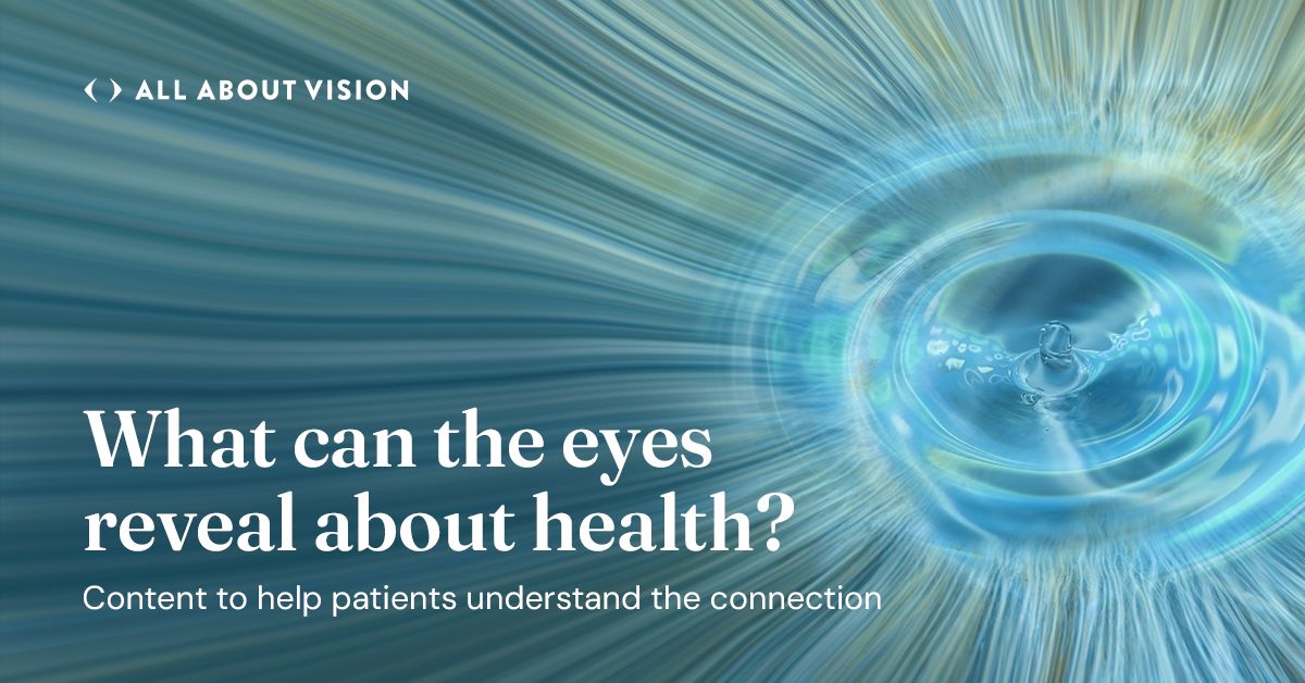 All About Vision ad