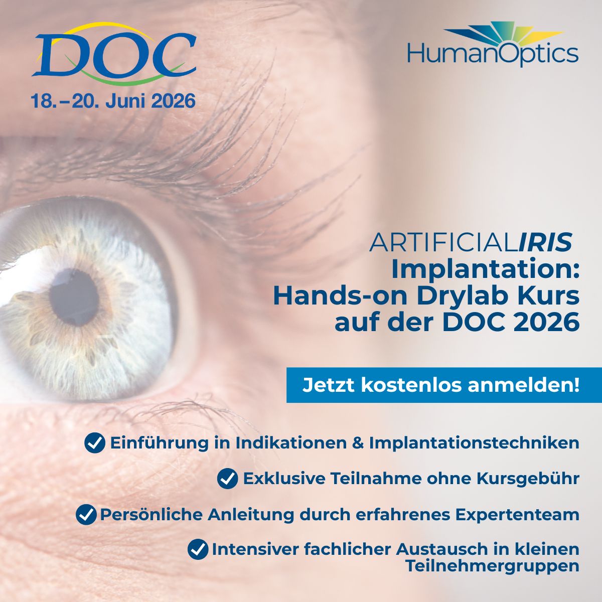 HumanOptics Holding AG ad