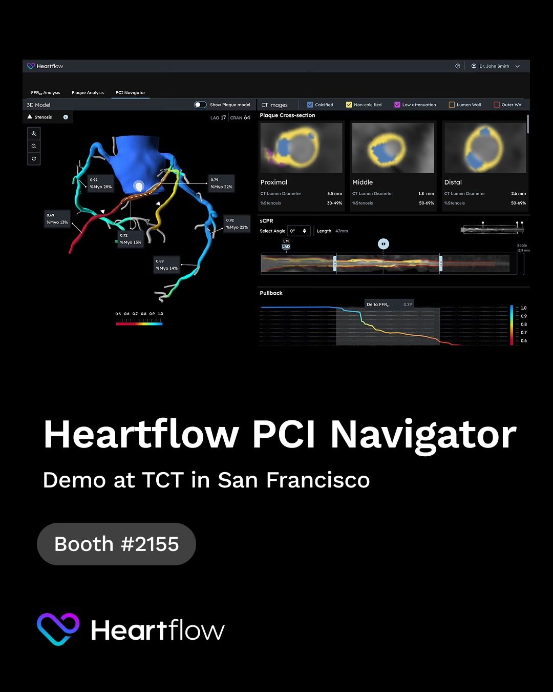 Heartflow ad
