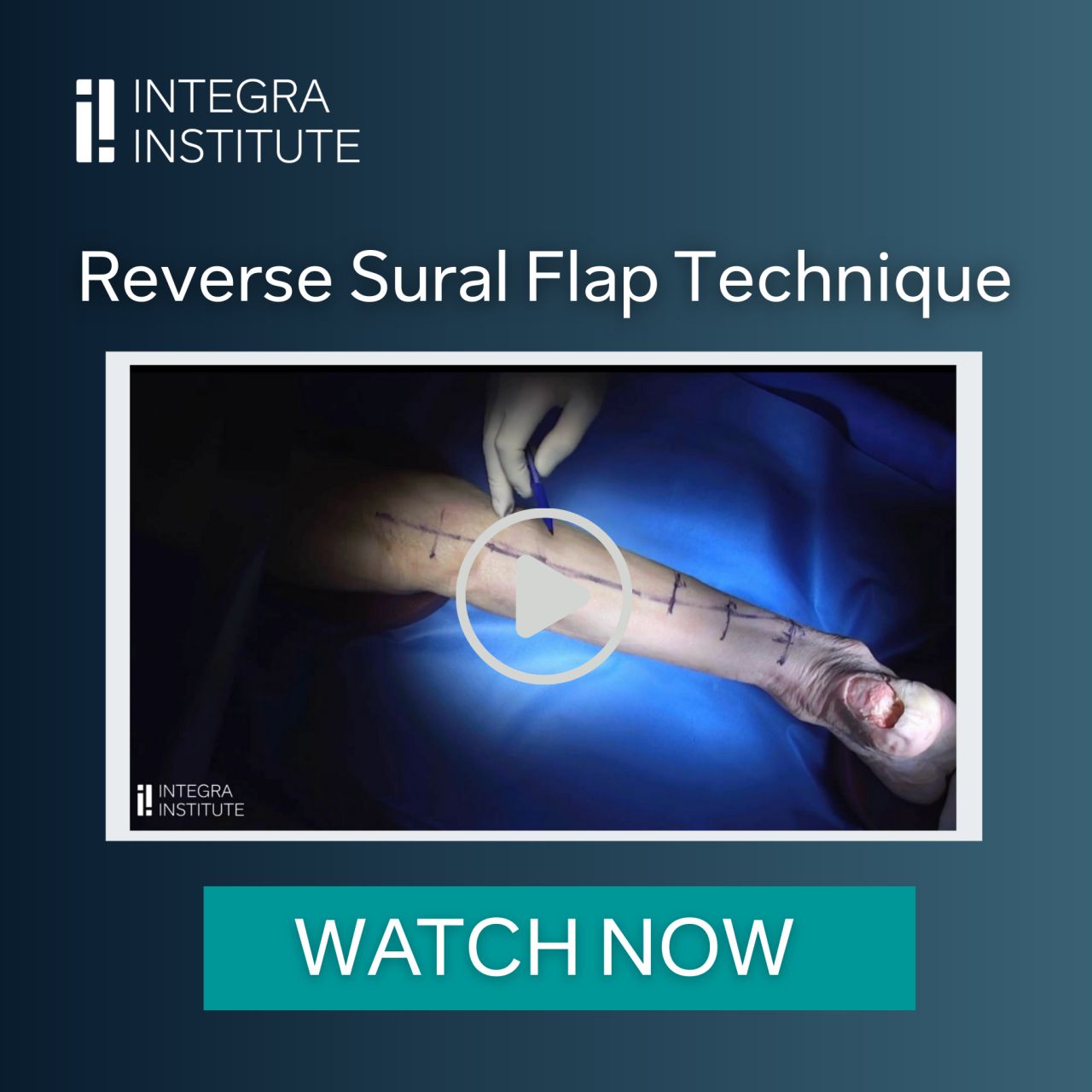 Integra LifeSciences ad