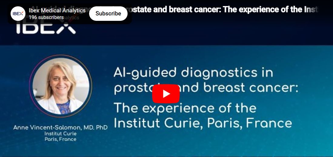 Ibex Medical Analytics ad