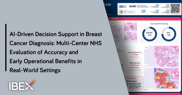Ibex Medical Analytics ad