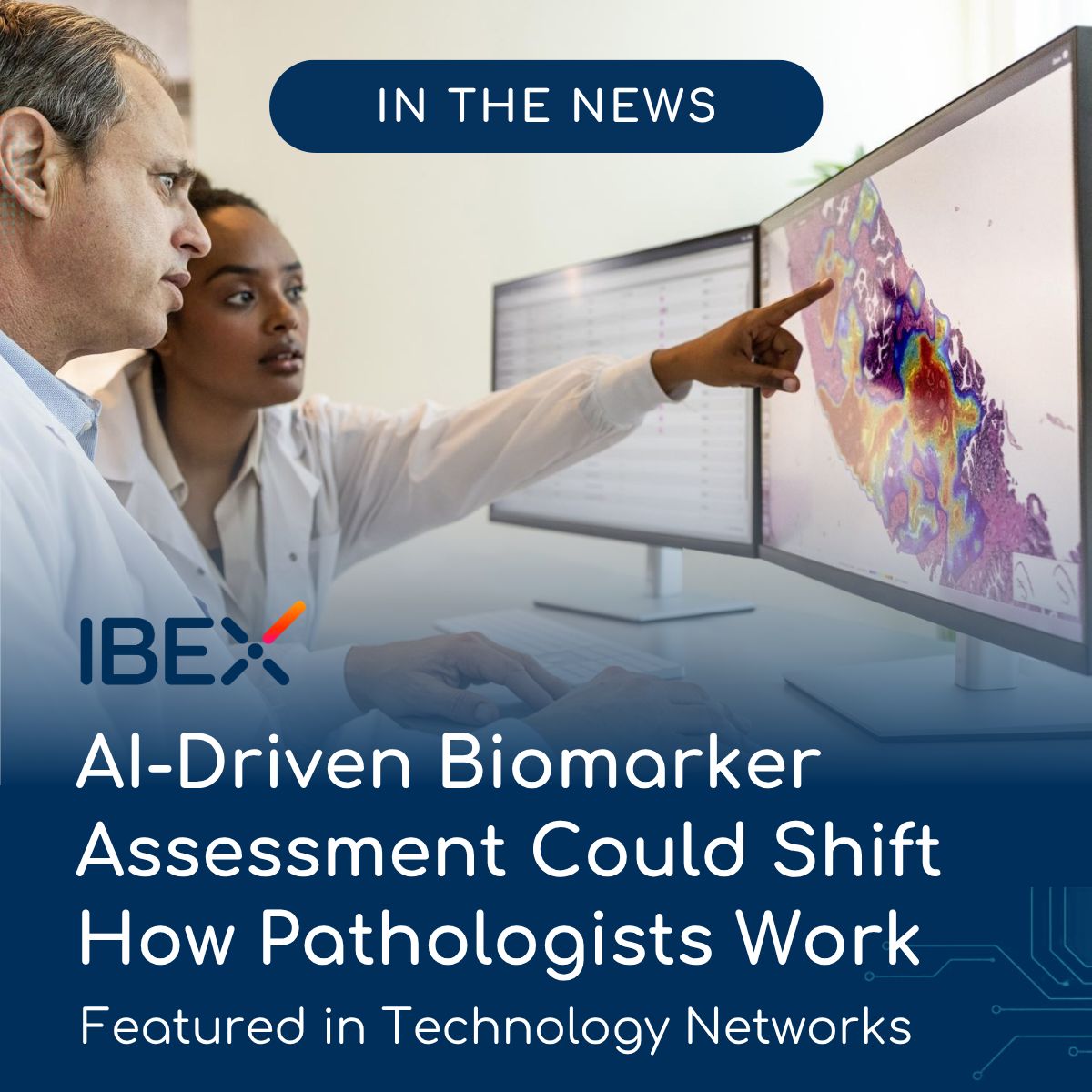 Ibex Medical Analytics ad