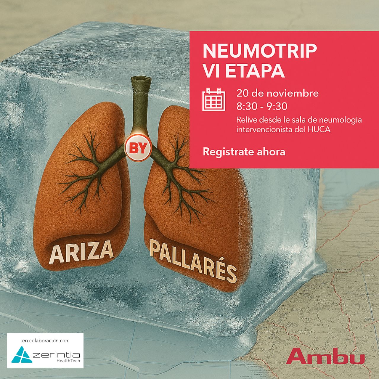 Ambu - España ad