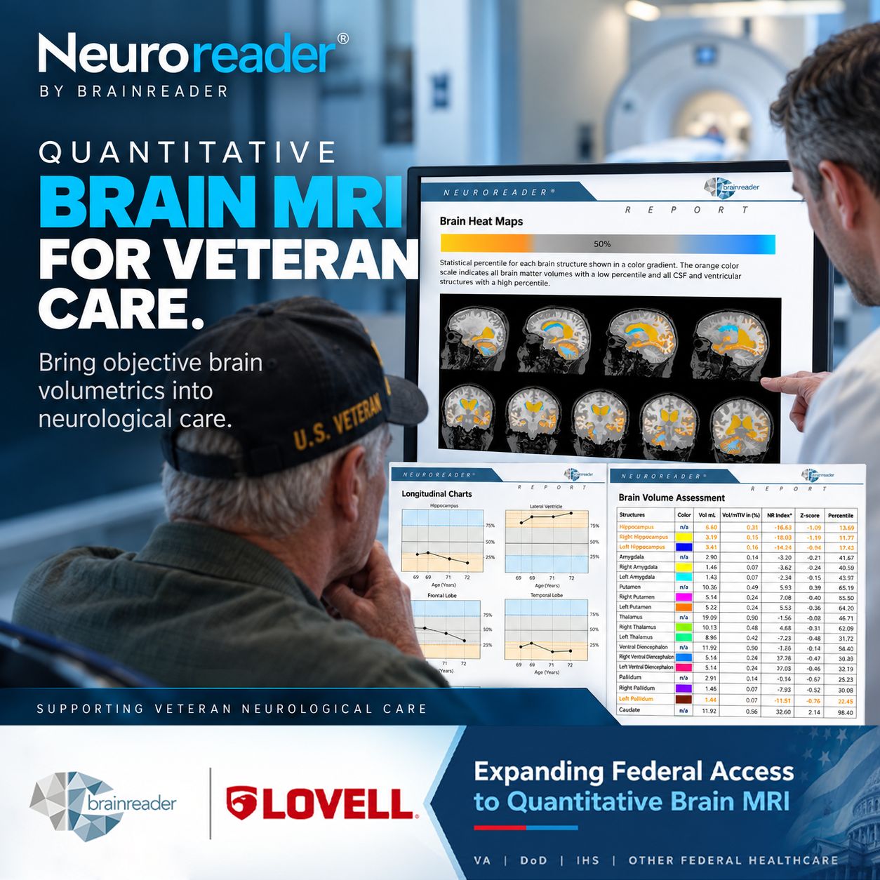 Brainreader ad