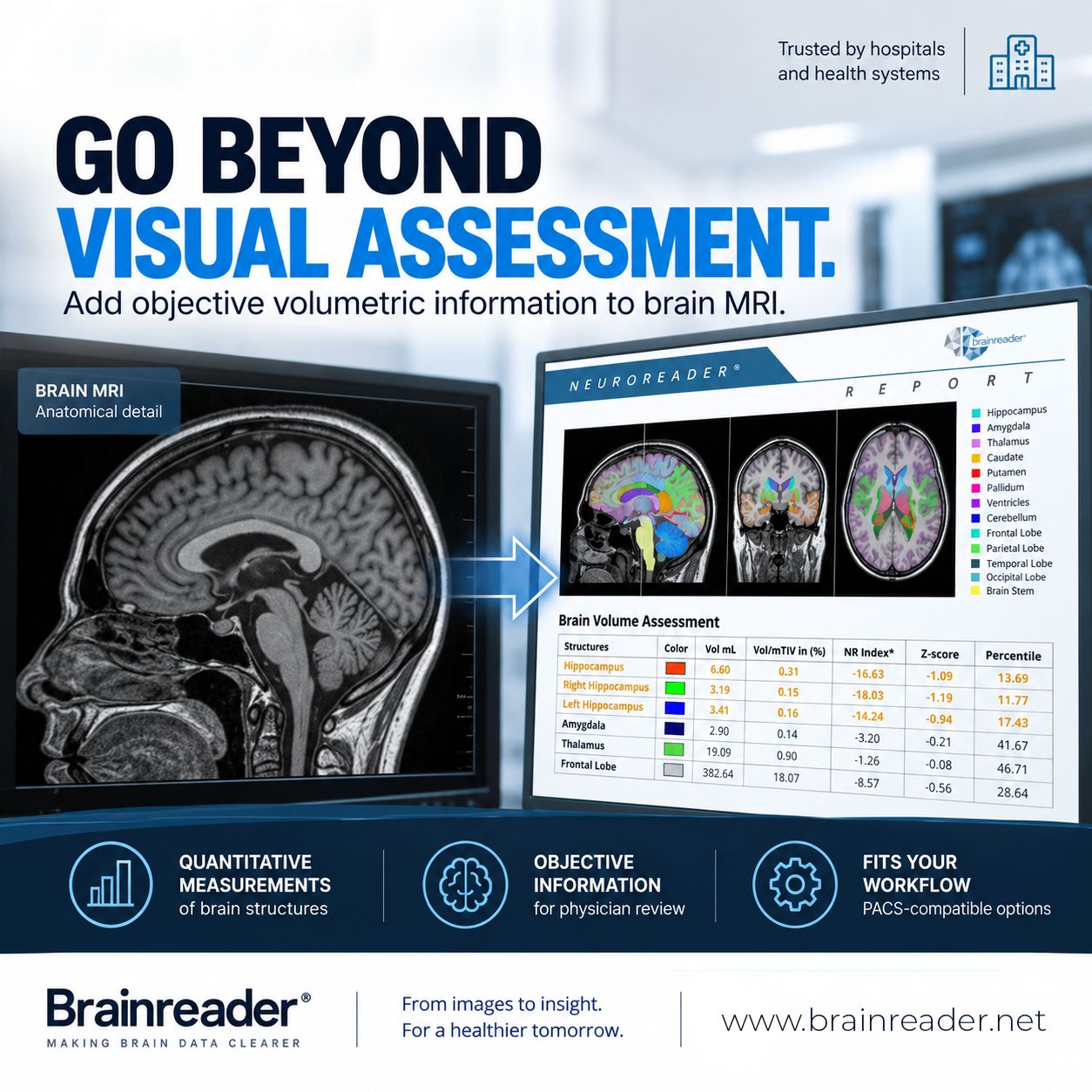 Brainreader ad