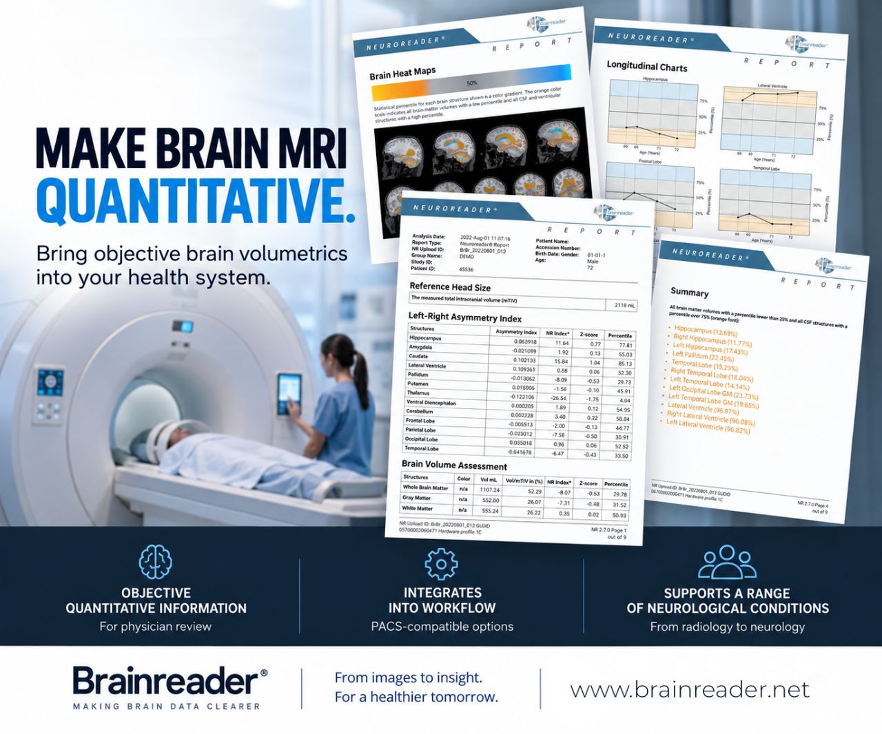 Brainreader ad