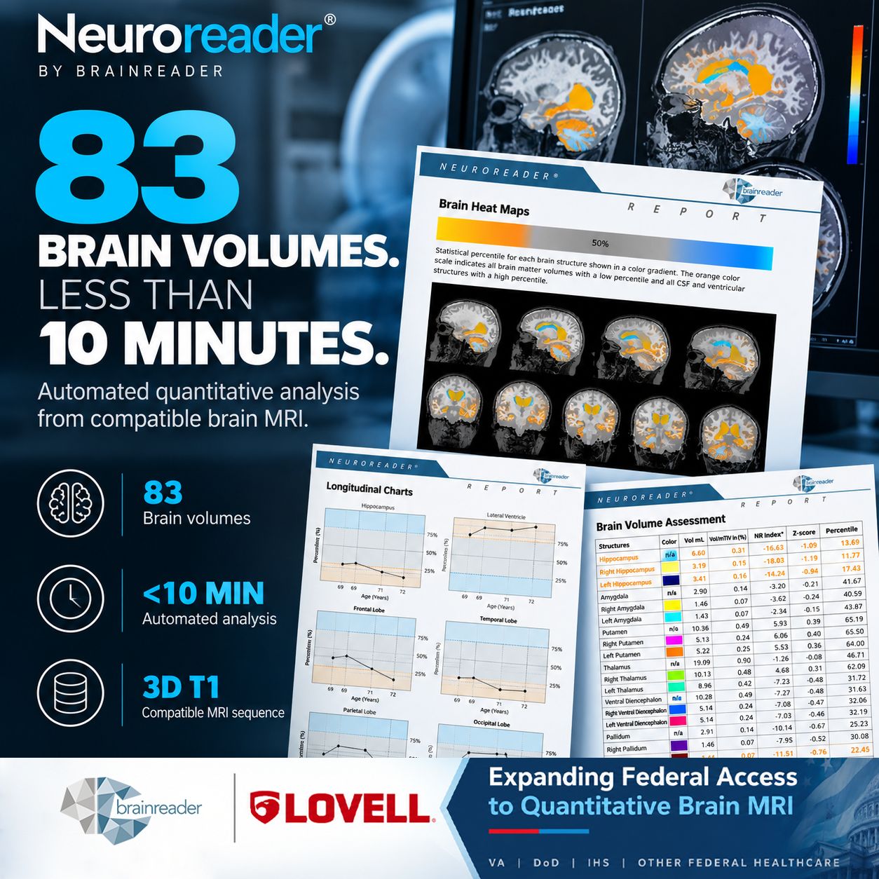Brainreader ad