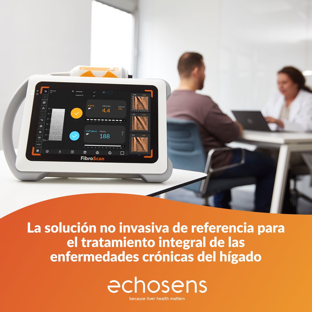 Echosens ad