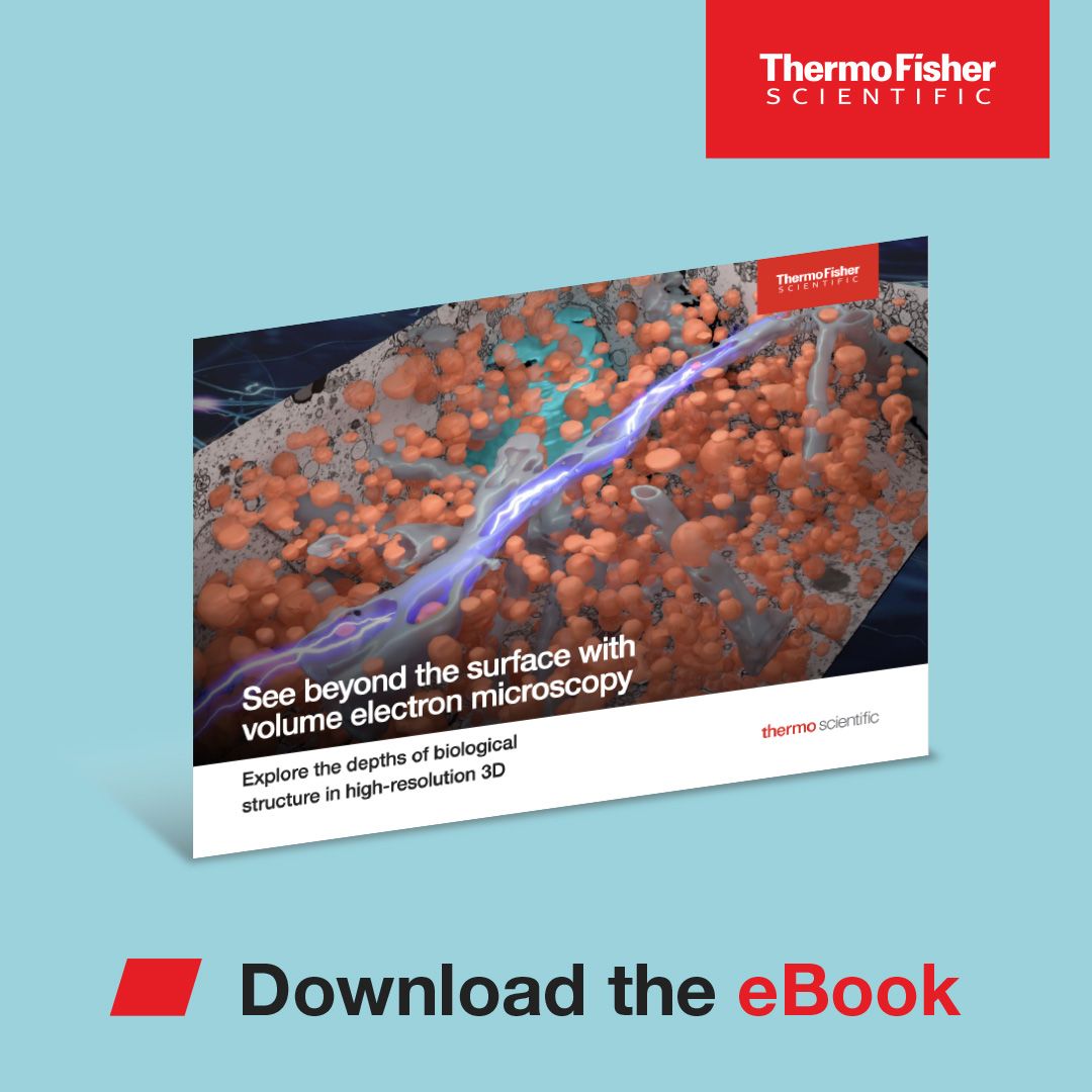 Thermo Fisher Scientific ad