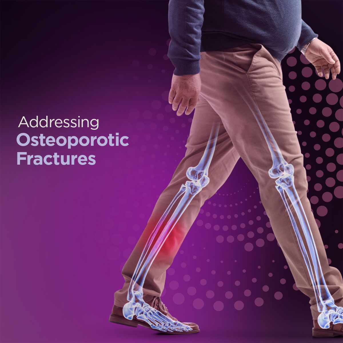 UPMC ad