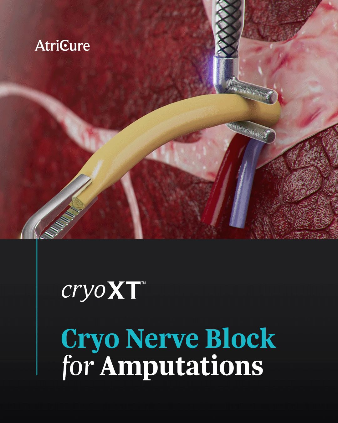 AtriCure, Inc. ad