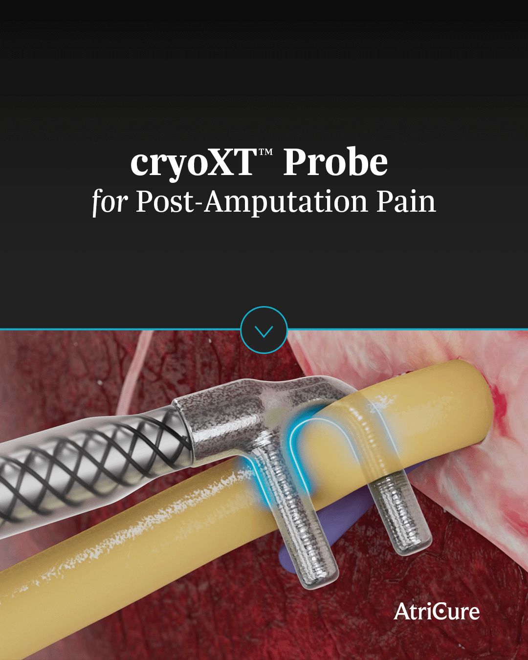 AtriCure, Inc. ad