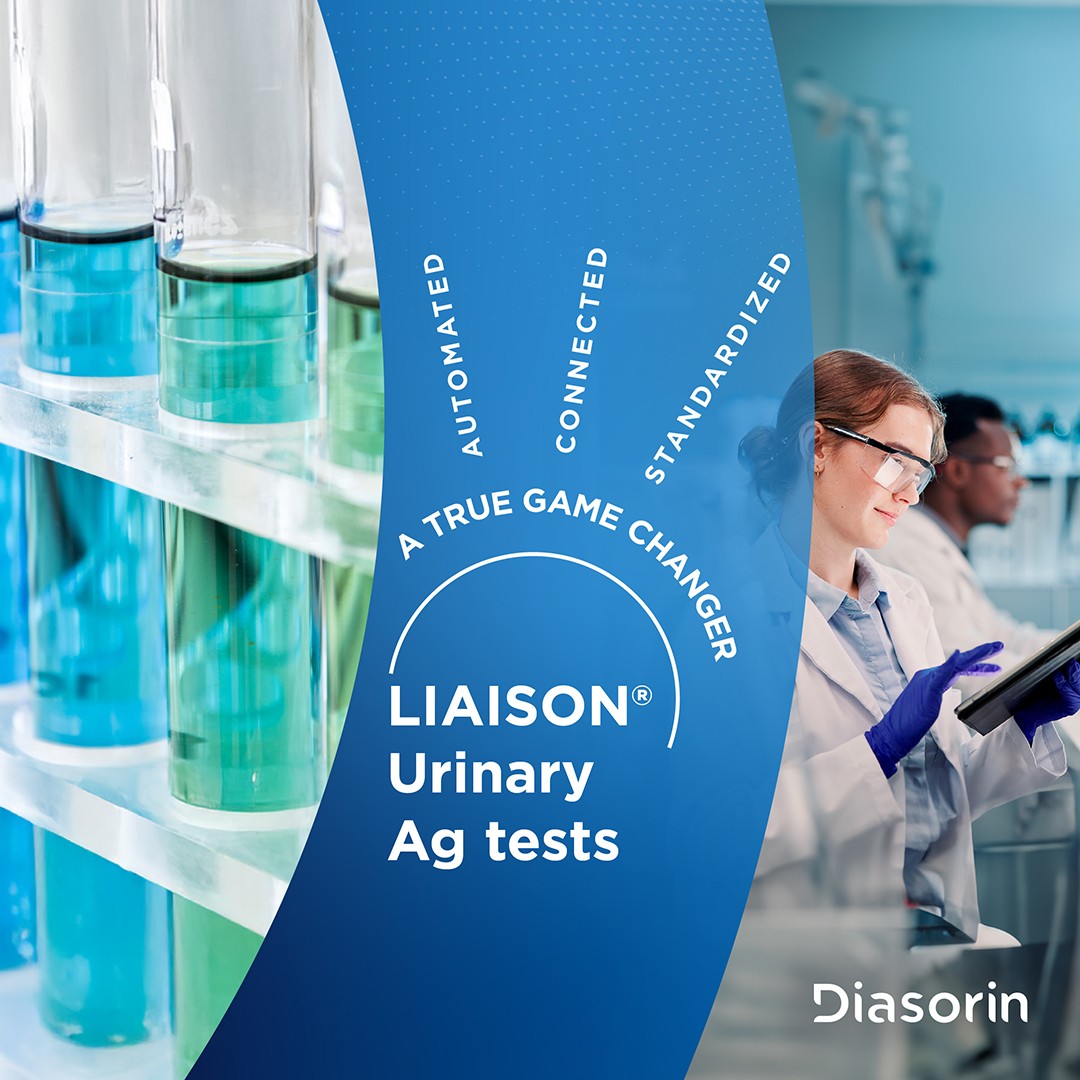 Diasorin ad