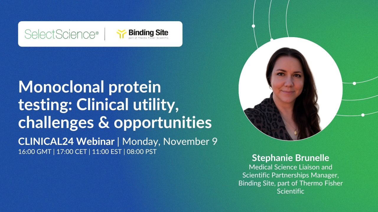 The Binding Site ad