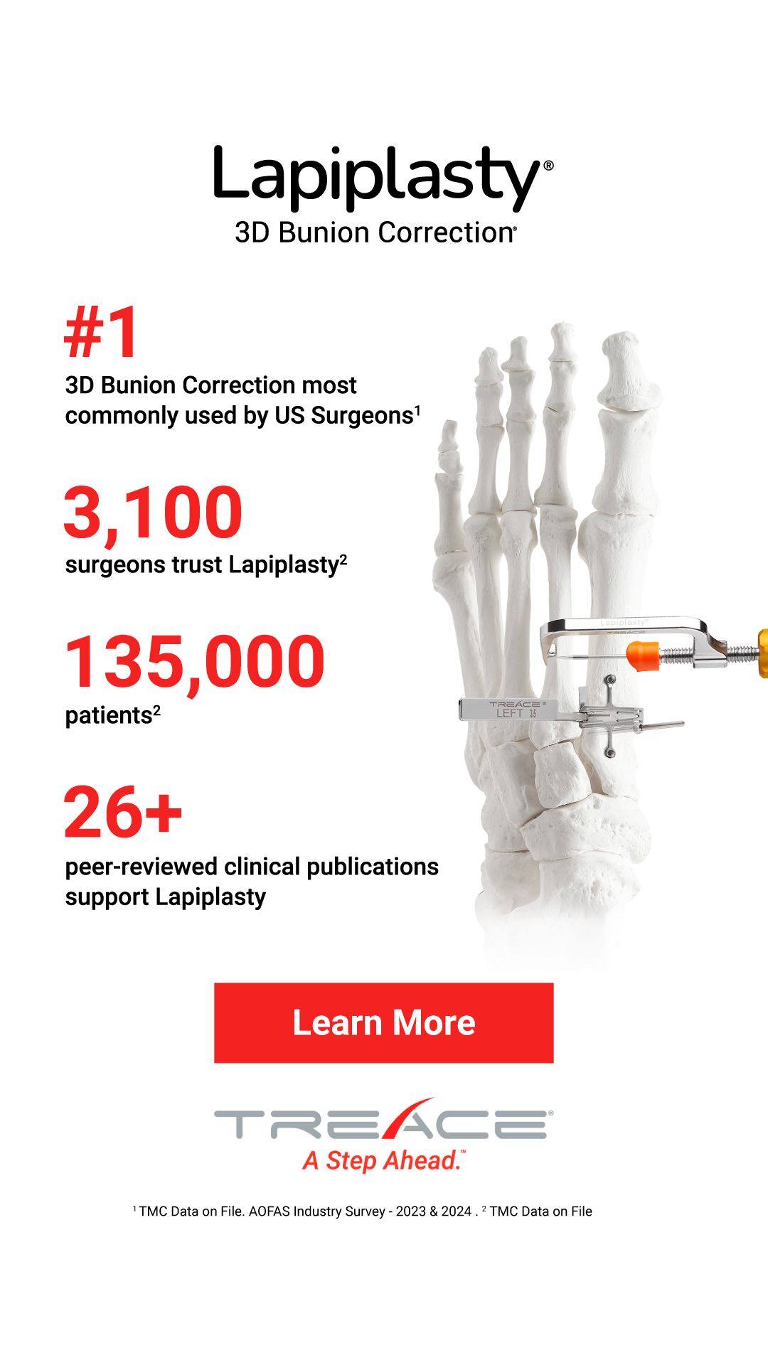 Treace Medical Concepts, Inc. ad