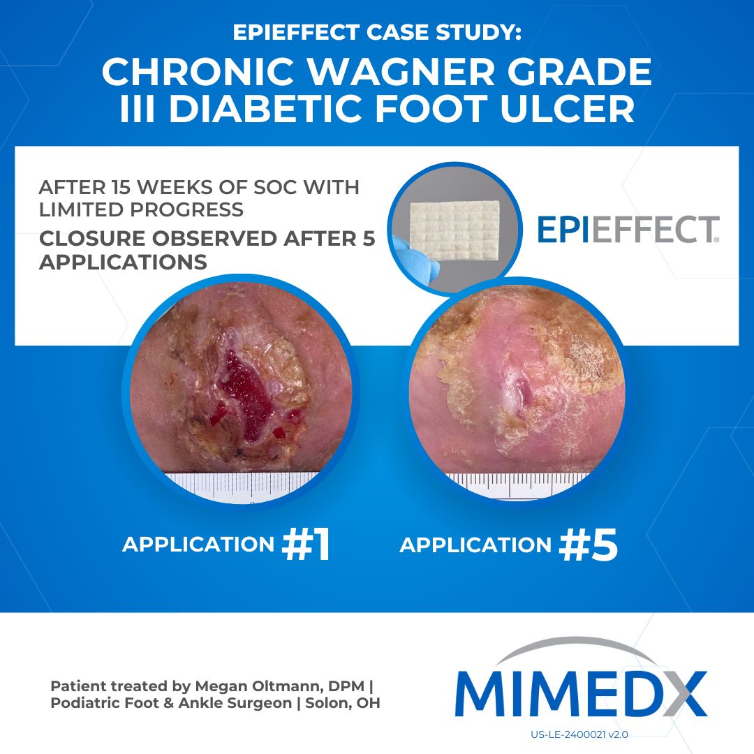 MiMedx ad