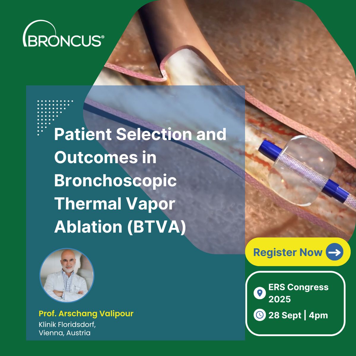 Broncus Medical, Inc. ad