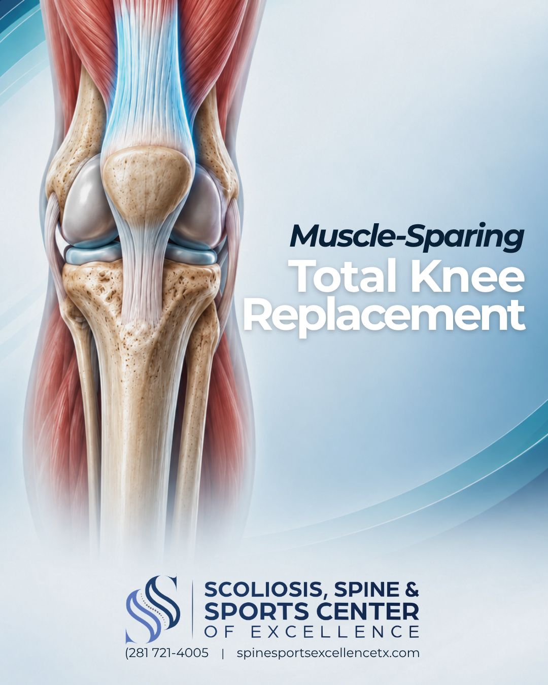 Scoliosis, Spine & Sports Center of Excellence ad