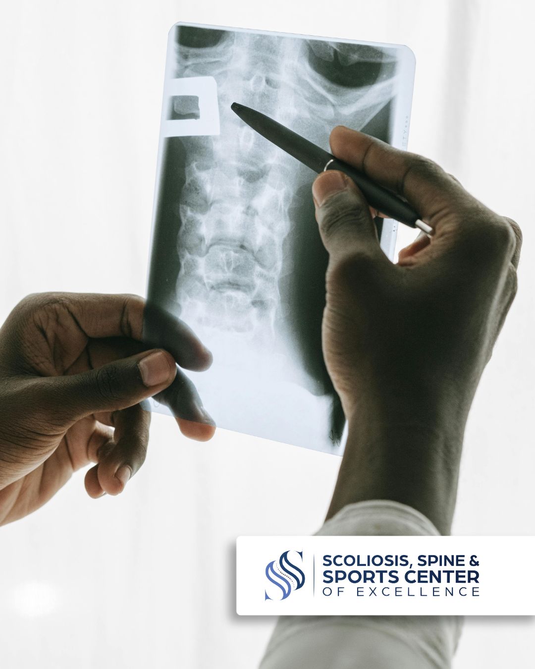 Scoliosis, Spine & Sports Center of Excellence ad