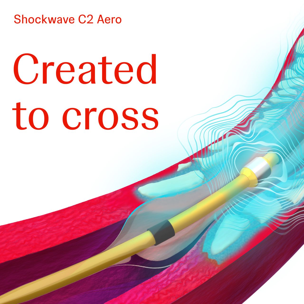 Johnson & Johnson MedTech | Circulatory Restoration ad