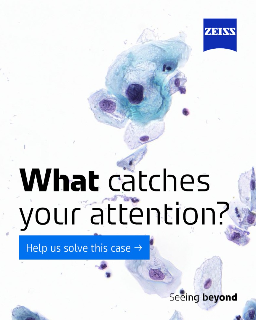 ZEISS Life Sciences Solutions ad