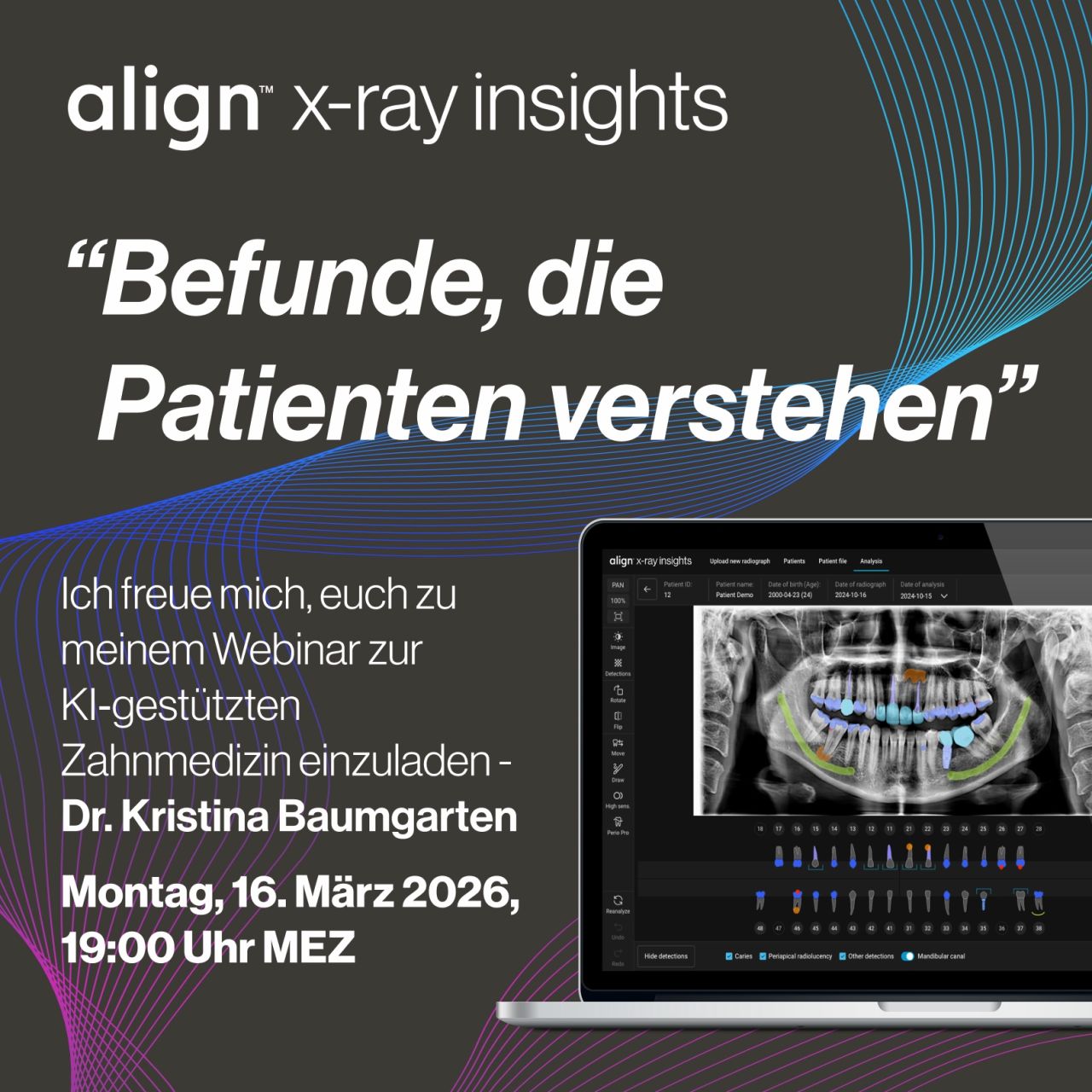 Align Technology ad