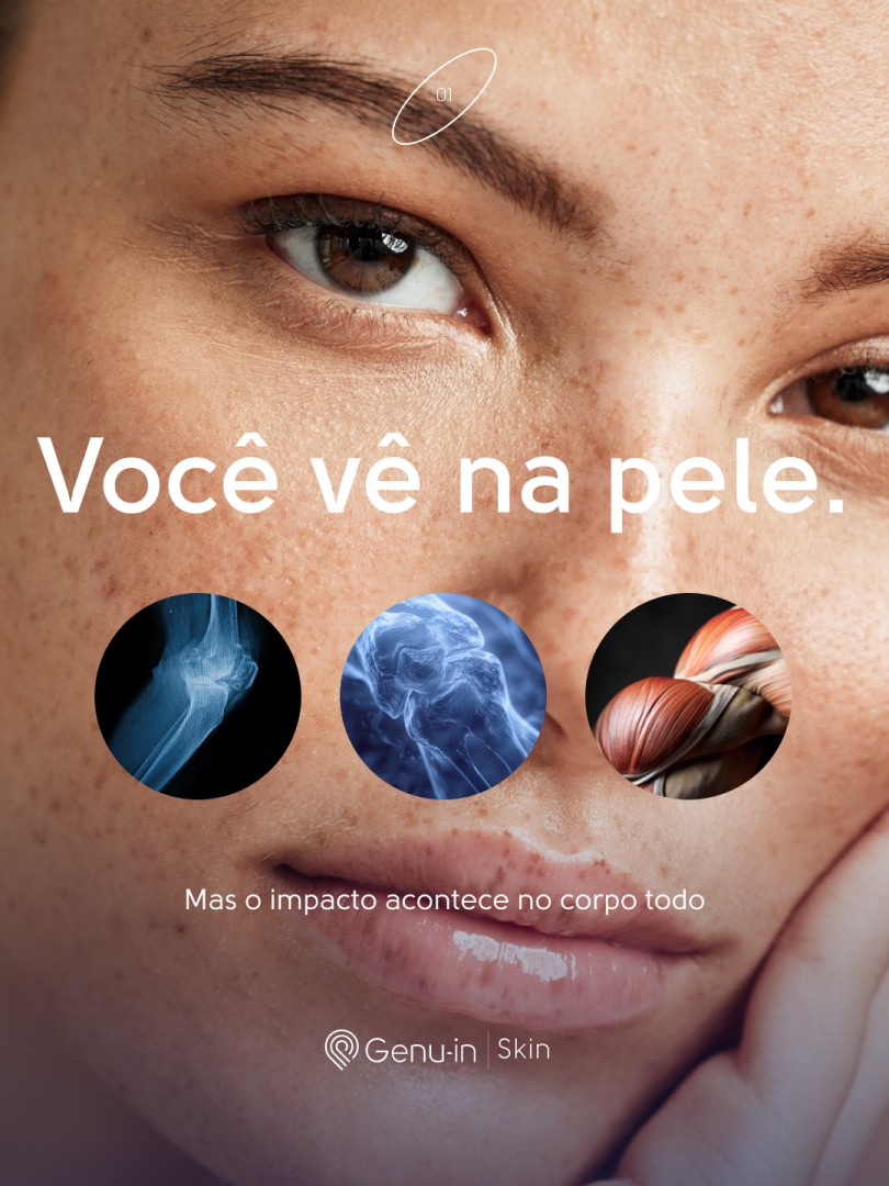 Genu-in® ad