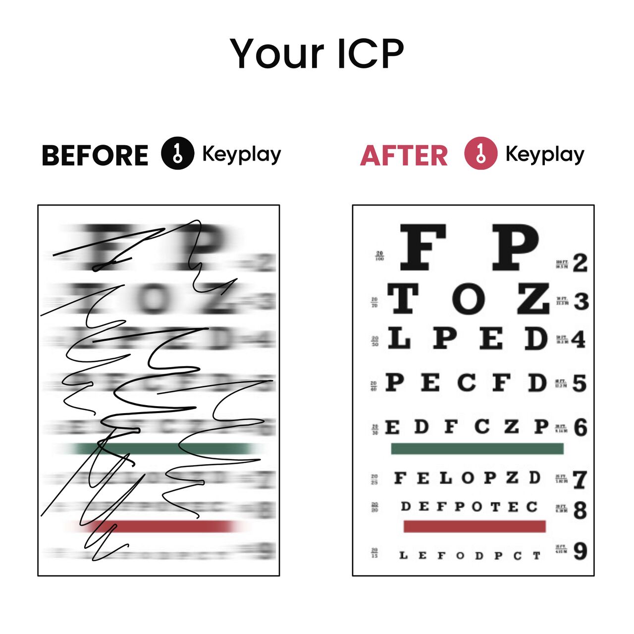 Keyplay ad