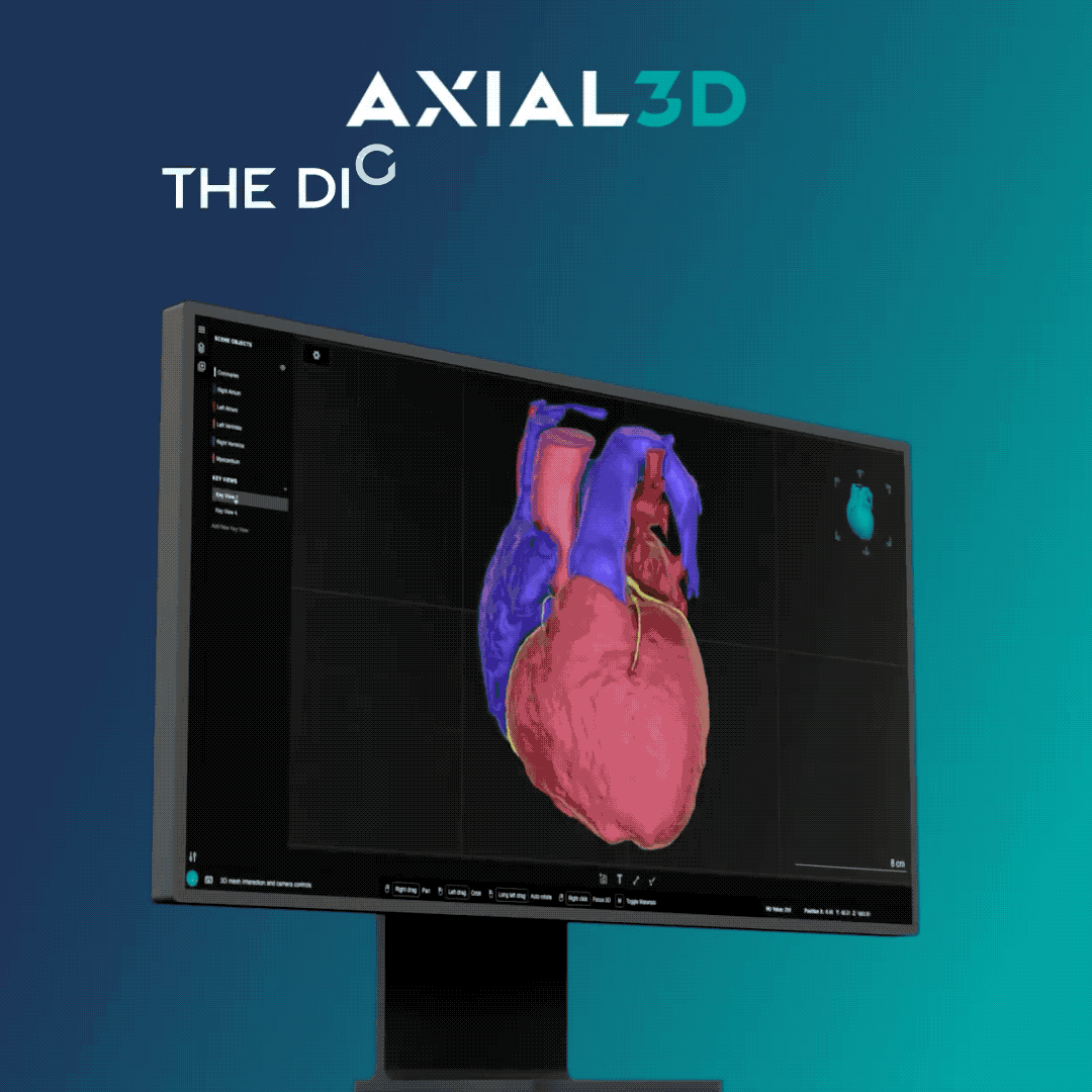 Axial3D ad