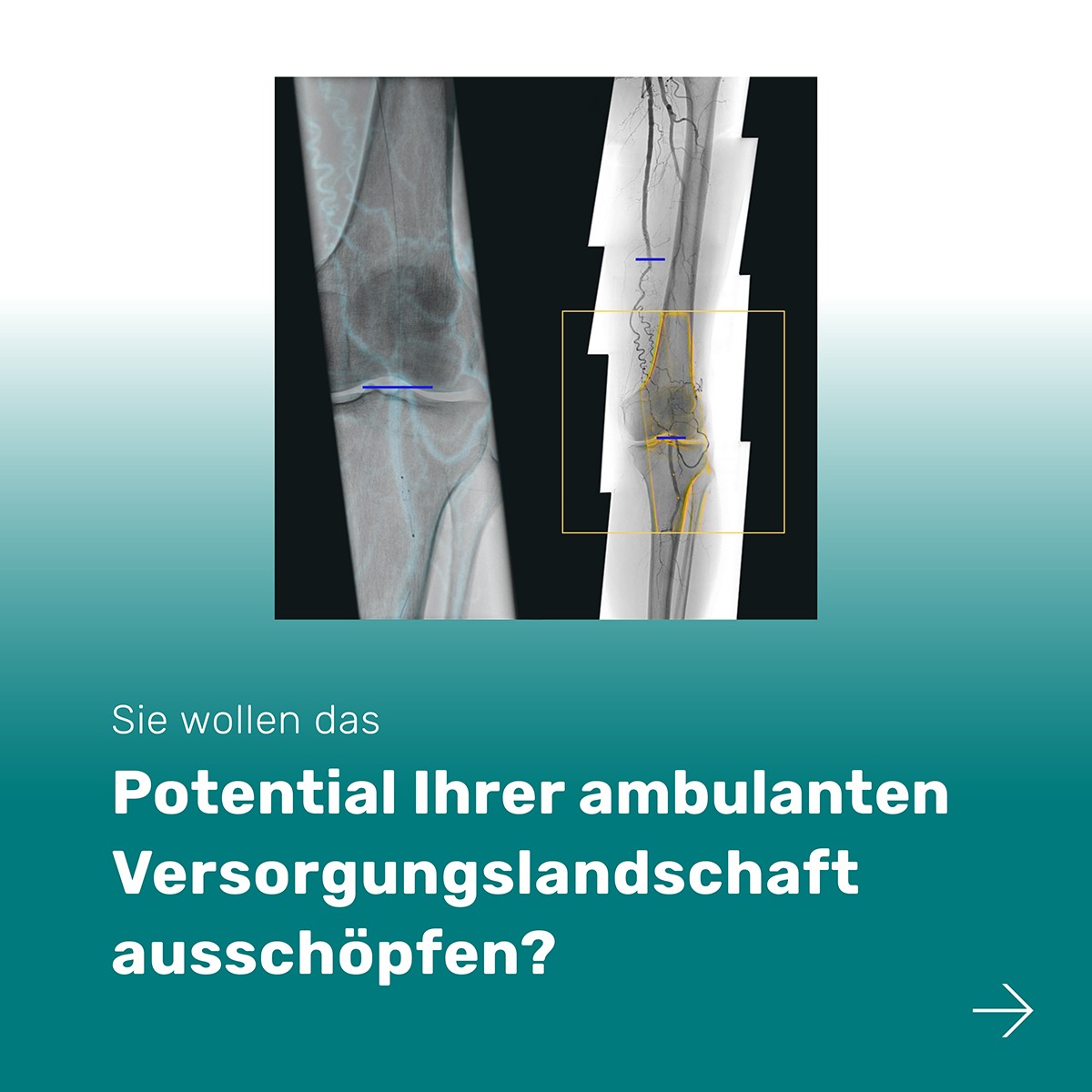 Ziehm Imaging ad